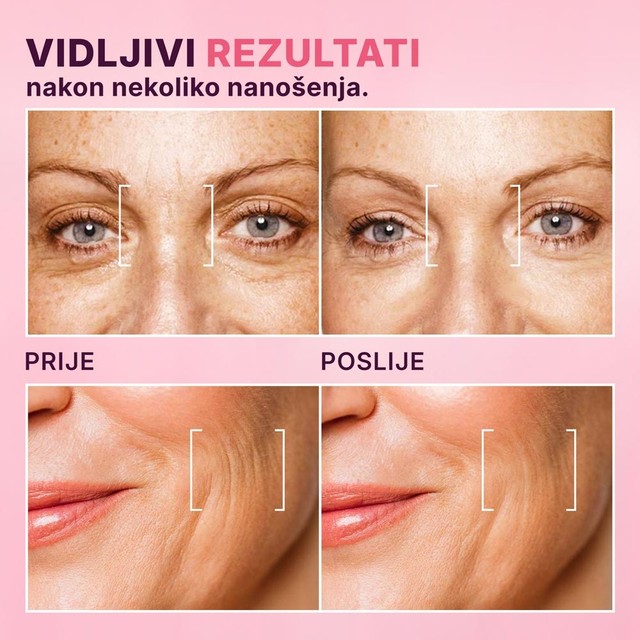 PRIJE-POSLIJE